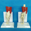 Médico de la articulación de la articulación de la rodilla esqueleto modelo funcional (R040105)